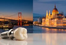 Ein makelloses Keramik-Zahnimplantat im Vordergrund, mit einem unscharfen, geteilten Hintergrund, der auf der einen Seite die Skyline von Istanbul in der Türkei und auf der anderen Seite die von Budapest in Ungarn zeigt, was die Wahl für eine Zahnbehandlung im Ausland symbolisiert.