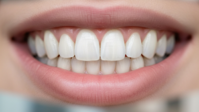 Nahaufnahme eines breiten, strahlenden Lächelns mit sehr weißen, perfekt ausgerichteten Zähnen, das die ästhetischen Vorteile von Veneers zeigt. Der Hintergrund ist unscharf und suggeriert eine moderne, saubere Umgebung.