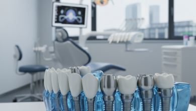 Nahaufnahme eines durchscheinenden 3D-Modells eines kompletten Systems von Zahnimplantaten, das in eine abstrakte Knochenstruktur eingesetzt ist. Im unscharfen Hintergrund ist eine moderne, sterile deutsche Zahnarztpraxis und eine angedeutete Stadtsilhouette zu sehen, alles in einem professionellen und klinischen Stil dargestellt.
