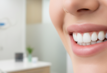 Ein Nahaufnahme-Bild eines strahlenden, gesunden Lächelns mit perfekt aufgehellten Zähnen, umgeben von weichen Lippen. Im unscharfen Hintergrund sind die eleganten, minimalistischen Elemente einer modernen Zahnarztpraxis oder Ästhetikklinik zu erkennen, was die professionelle Qualität der Behandlung unterstreicht. Das Bild vermittelt einen Eindruck von Hygiene, Ästhetik und dem Wunsch nach einem schönen Lächeln, mit einem dezenten Hinweis auf europäisches Design.