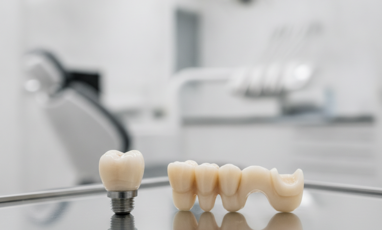 Nahaufnahme von zwei verschiedenen, makellosen Zahnersatzlösungen – einer einzelnen Zahnkrone, die ein Implantat darstellt, und einer dreigliedrigen Zahnbrücke – beide auf einer sterilen, glänzenden Oberfläche präsentiert. Im unscharfen Hintergrund ist eine moderne, professionelle Zahnklinik zu erkennen.