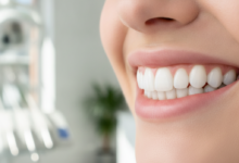 Nahaufnahme eines strahlenden Lächelns mit perfekt weißen Zähnen in einem hellen, modernen zahnmedizinischen Umfeld, das die Ästhetik von Veneers hervorhebt. Der Hintergrund ist weich gezeichnet.