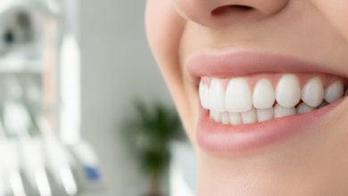 Nahaufnahme eines strahlenden Lächelns mit perfekt weißen Zähnen in einem hellen, modernen zahnmedizinischen Umfeld, das die Ästhetik von Veneers hervorhebt. Der Hintergrund ist weich gezeichnet.