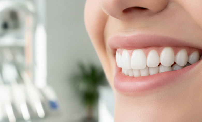 Nahaufnahme eines strahlenden Lächelns mit perfekt weißen Zähnen in einem hellen, modernen zahnmedizinischen Umfeld, das die Ästhetik von Veneers hervorhebt. Der Hintergrund ist weich gezeichnet.