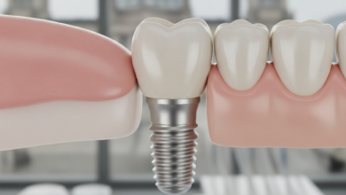 Ultra-detaillierte Nahaufnahme eines perfekt integrierten Zahnimplantats in einem gesunden menschlichen Gebiss, umgeben von sauberem Zahnfleisch. Das Implantat und die Zahnkrone wirken sehr natürlich. Der Hintergrund ist unscharf und deutet auf eine moderne Zahnklinik hin, mit einem extrem subtilen, verschwommenen Hinweis auf eine Berliner Stadtansicht im äußersten Hintergrund.